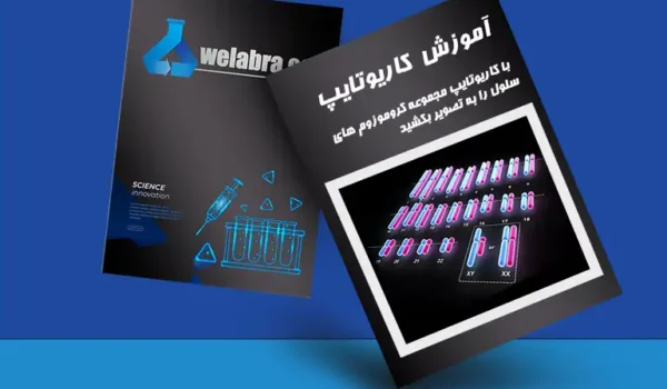 کاریوتایپ کاریوگرام ویلابرا |welabra.com