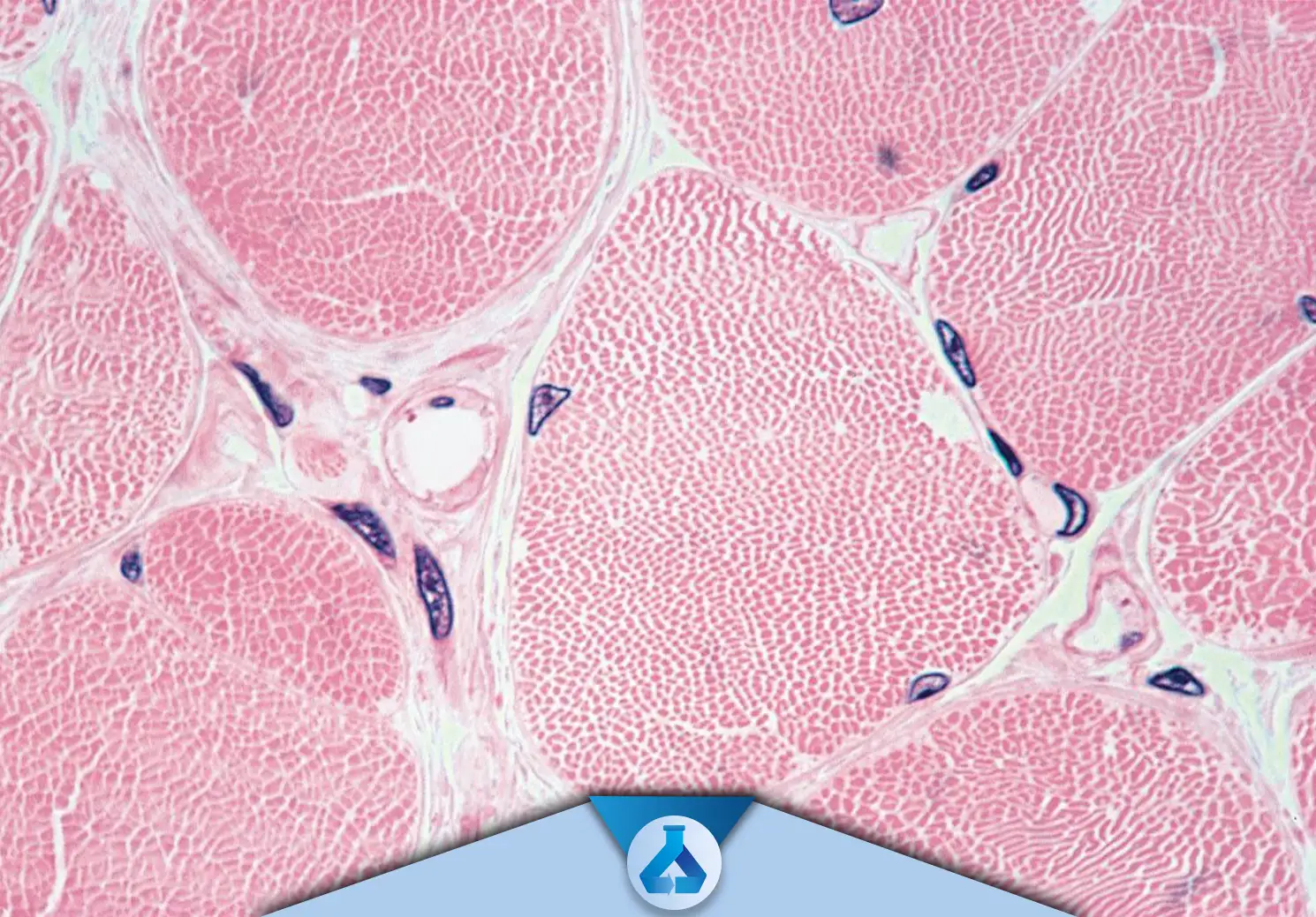 بلاست های عضلات اسکلتی (سلول های ماهواره ای Satellite Cells) سلول های پیش ساز عضلانی هستند که در لایه بازال فیبر های عضلات بالغین قرار گرفته اند.